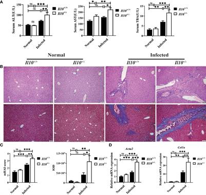 IL-10 regulates Th17 response to inhibit hepatobiliary injury caused by Clonorchis sinensis infection in C57BL/6J mice